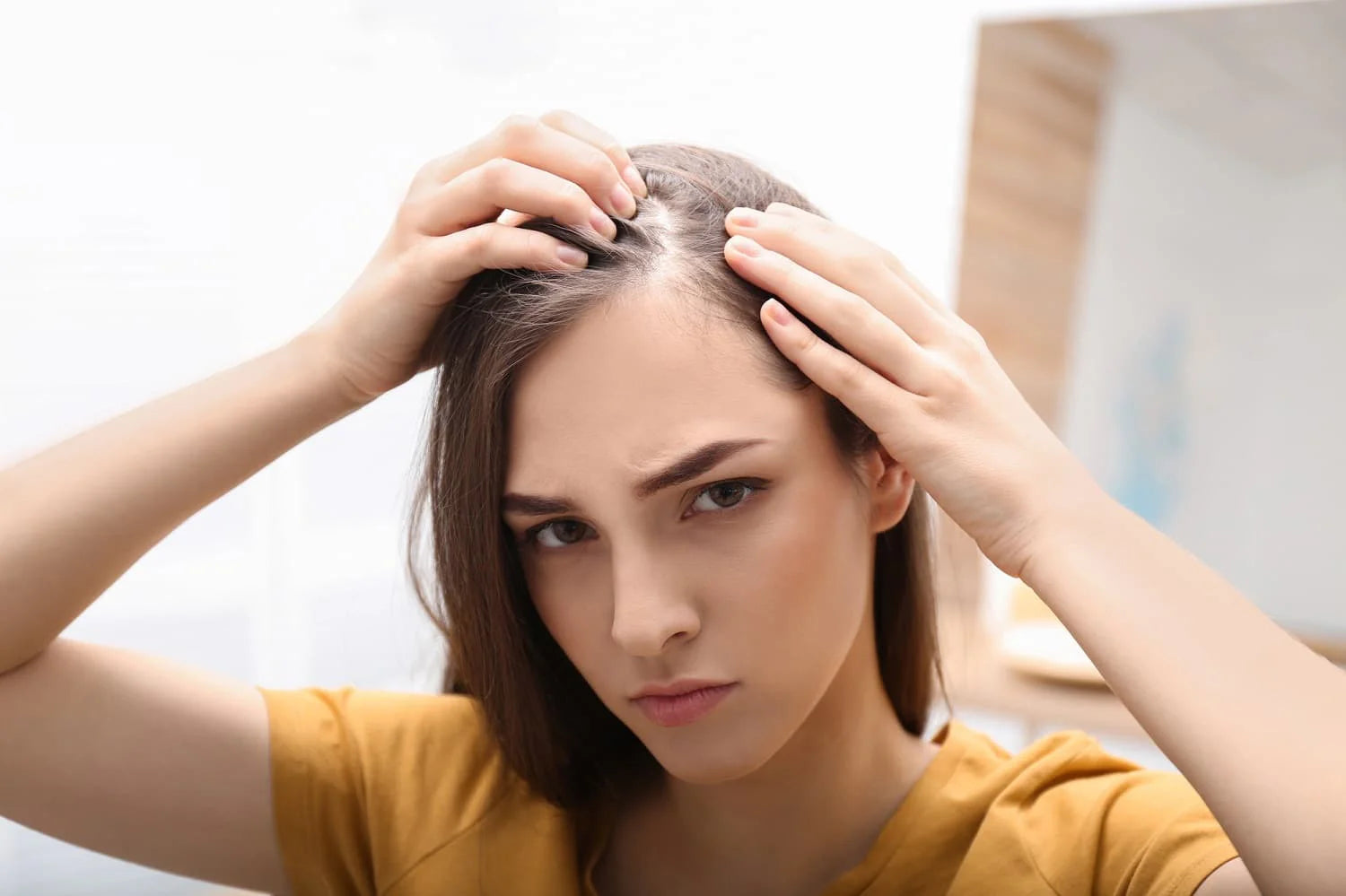 Alopecia perdida cabello